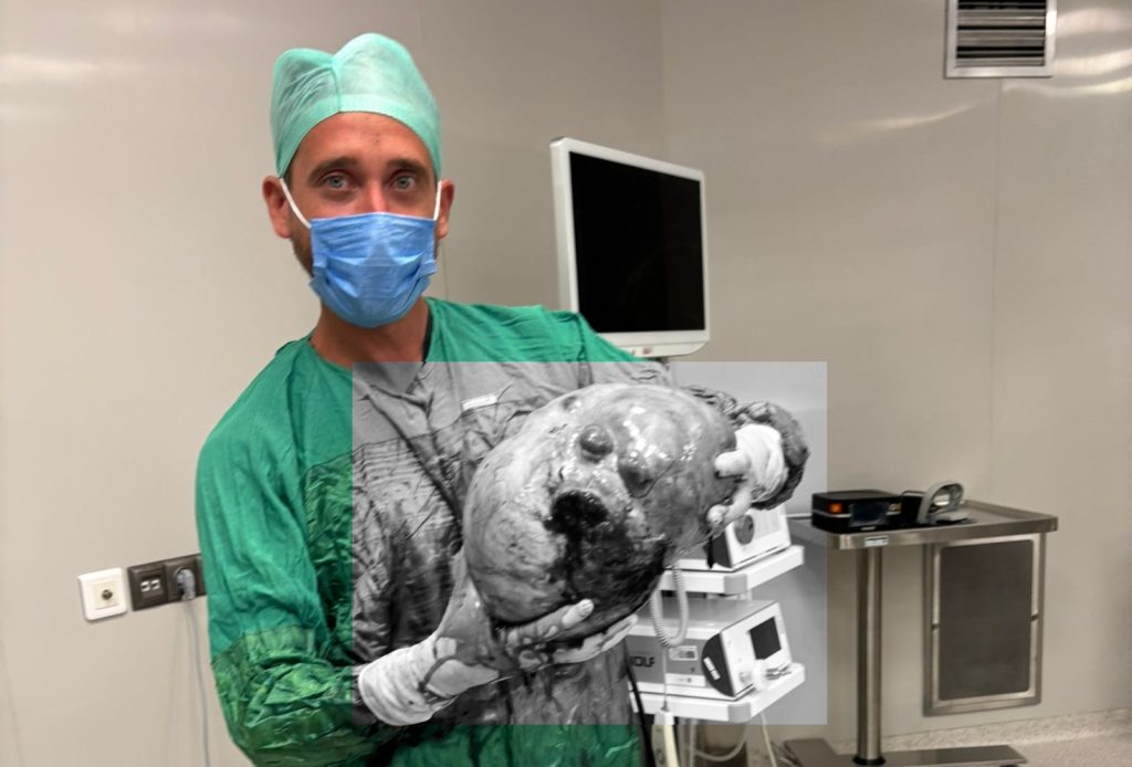 70 yaşındaki hastanın karnından dev kitle çıkarıldı